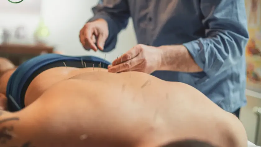 Acupuncture for back pain