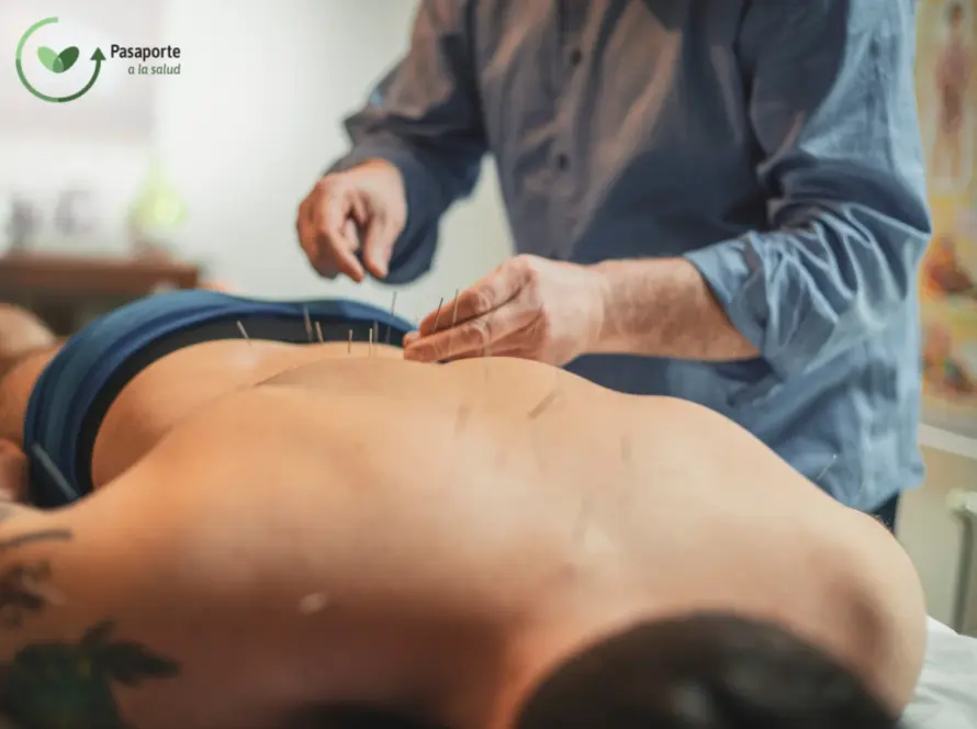 Acupuncture for back pain