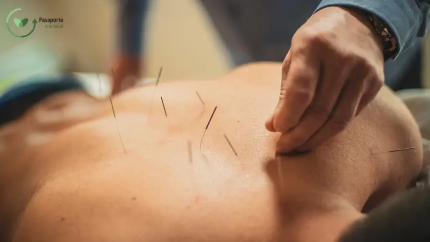 Acupuncture Treatment