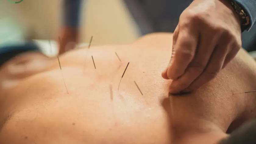 Acupuntura para el dolor de espalda