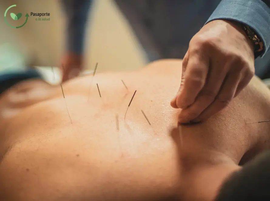 Acupuntura para el dolor de espalda
