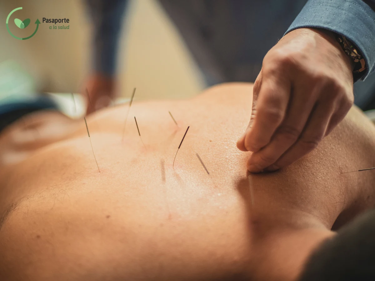 Acupuntura para el dolor de espalda