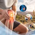 Tratamiento para dolor de articulaciones en Sonora